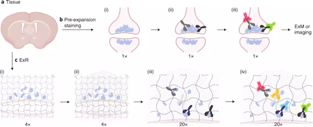 Revealing nanostructures in brain tissue via protein decrowding by iterative expansion microscopy - Nature Biomedical Engineering