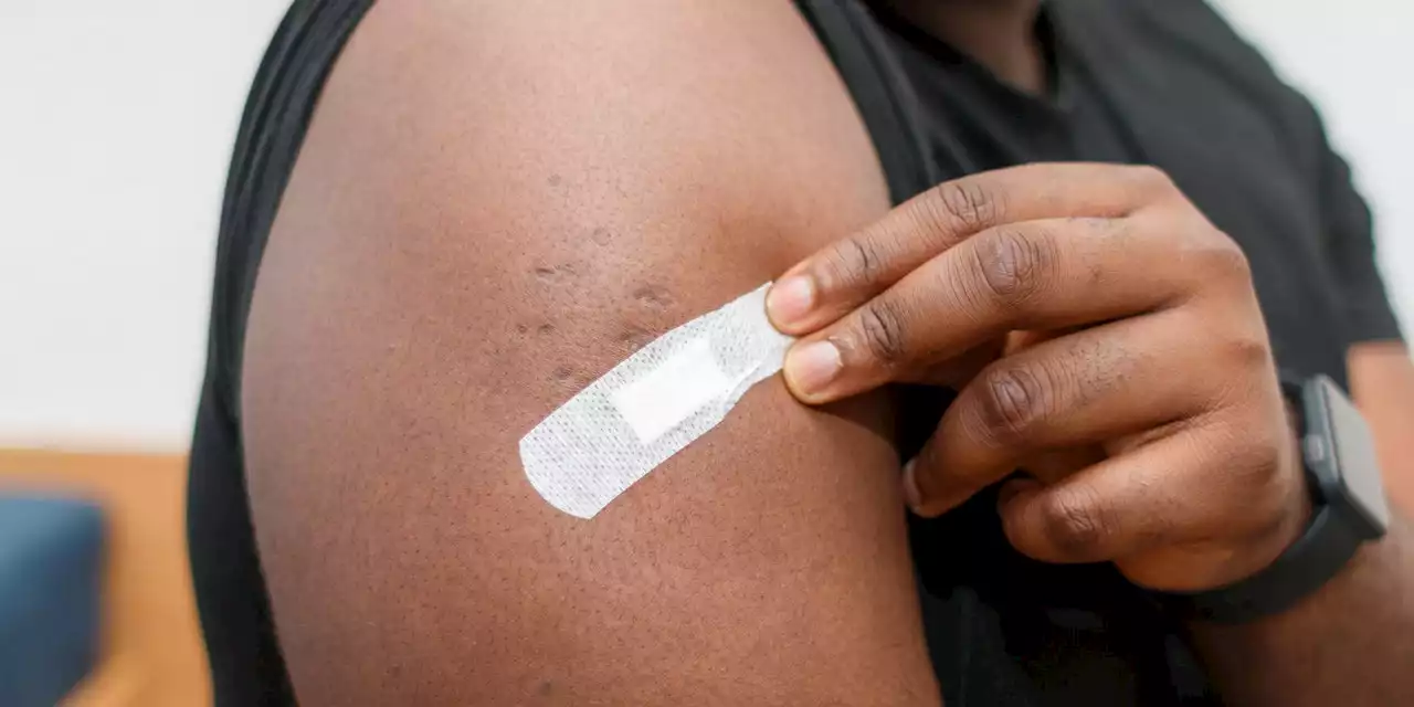 Here’s What You Should Know If Your Second Monkeypox Vaccine Has Been Delayed