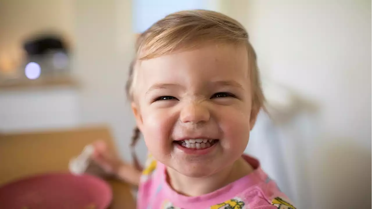 Toddler grinding teeth: Causes, symptoms and treatment