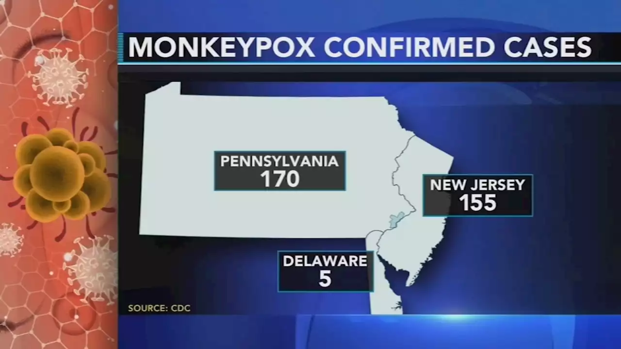 Health experts: Fall school semester could amplify spread of monkeypox