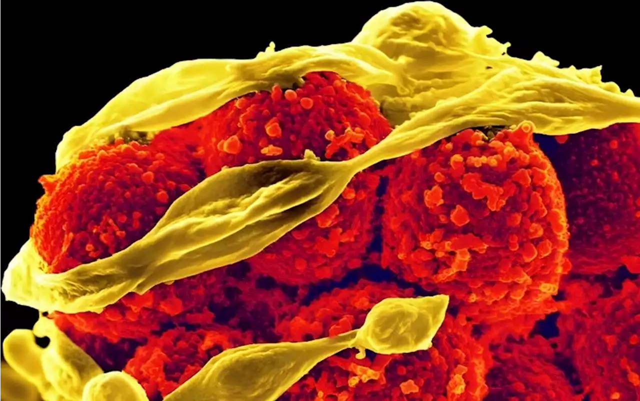 A Staph Vaccine Trial Failure Shows Challenges of Stopping Common Bugs