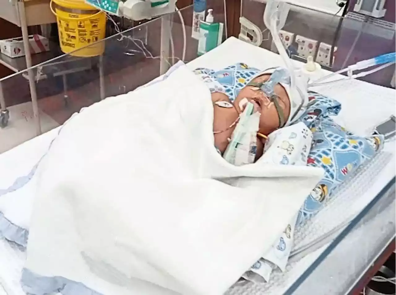 Sarawak family needs RM80,000 to pay for infant’s heart surgery