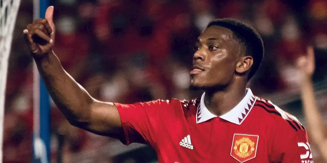 Duh, Anthony Martial Cedera Jelang Lawan Brighton? - Bola.net