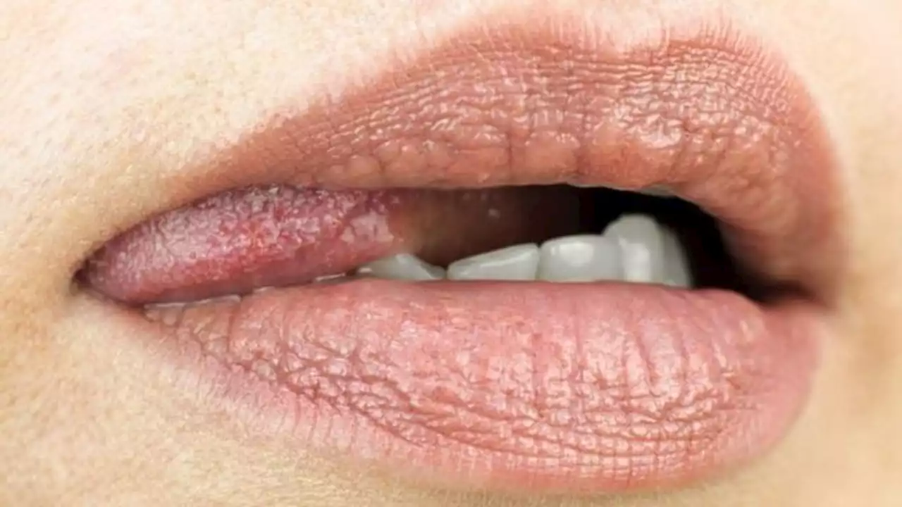 Sexo oral sem preservativo pode provocar doenças: entenda riscos e como se proteger