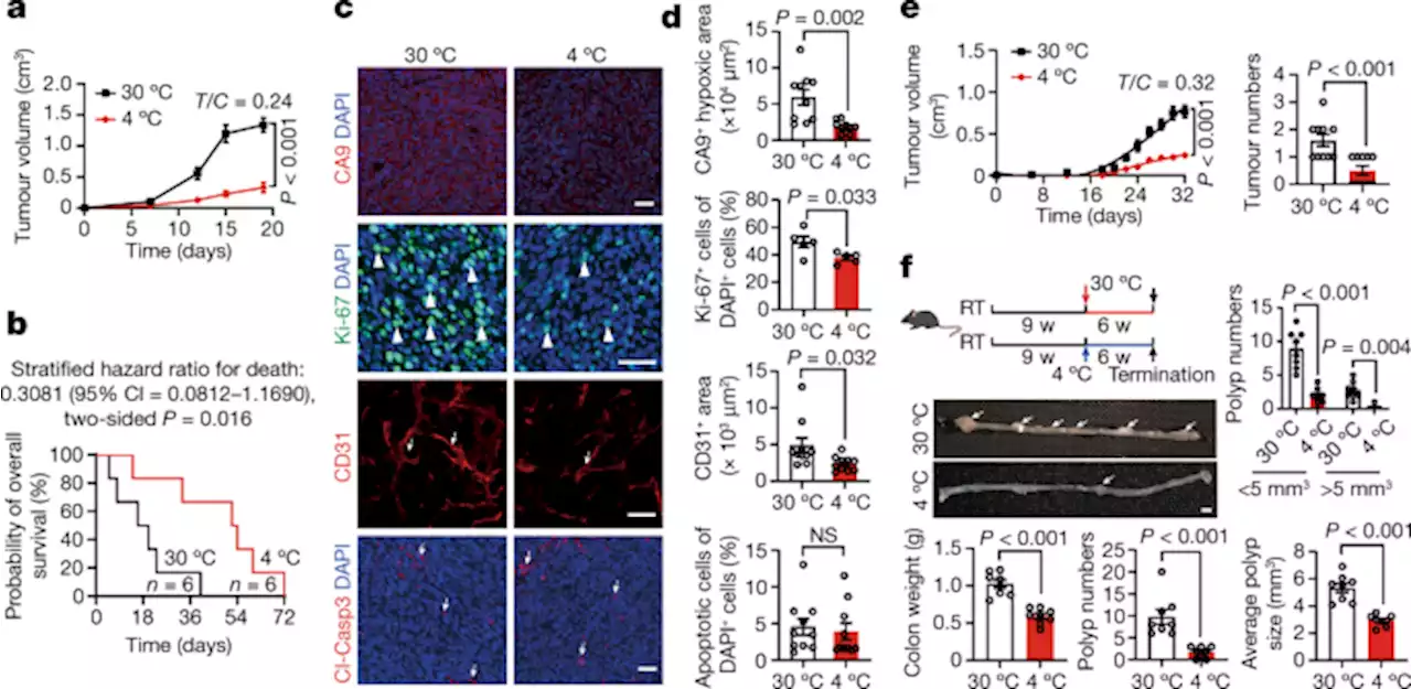 Brown-fat-mediated tumour suppression by cold-altered global metabolism - Nature