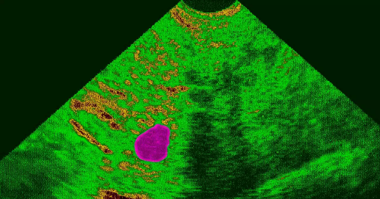 The Fall of Roe Makes Complex Pregnancies Even Riskier