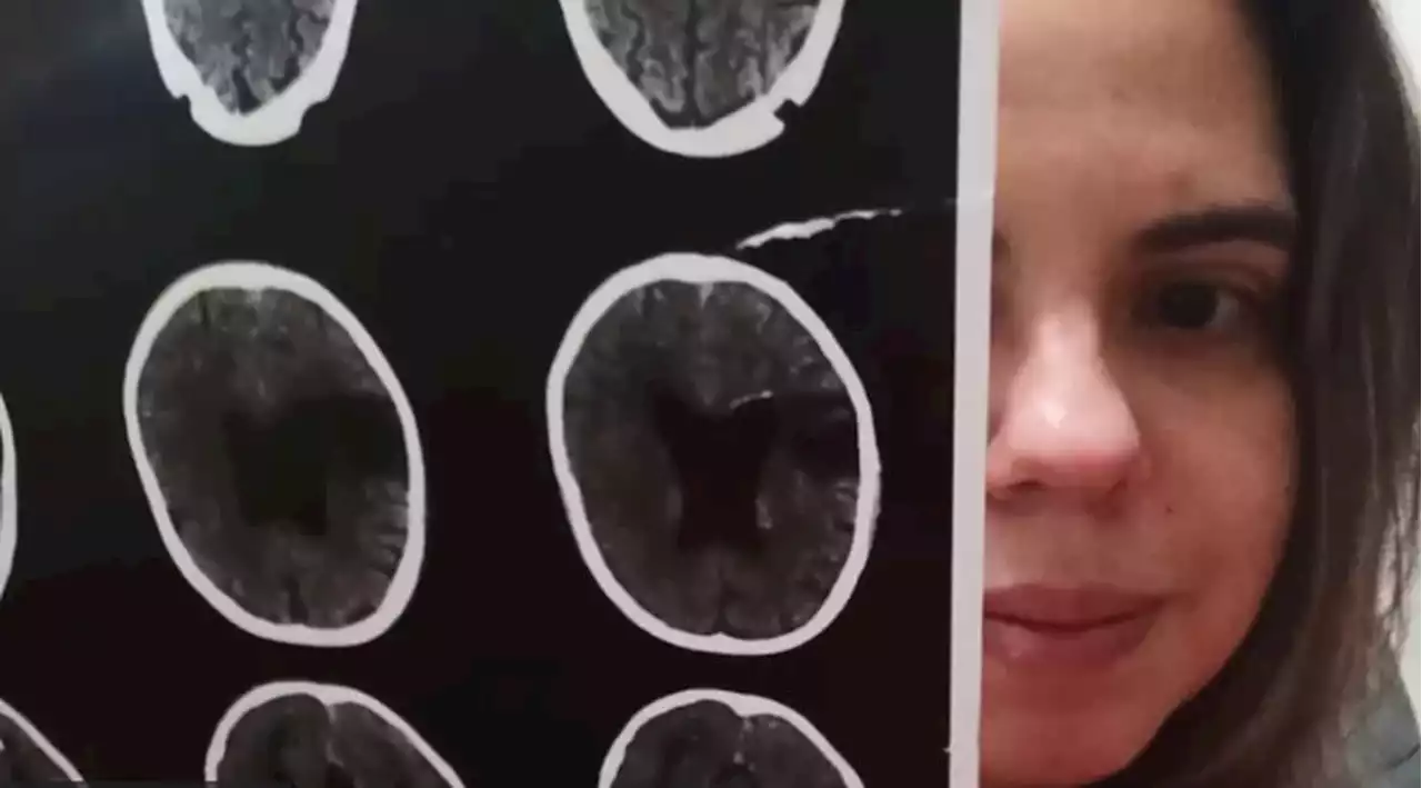 Agnosia visual: 'Confundi abacate com sapo, bota com galinha e tomate cereja com joaninhas'