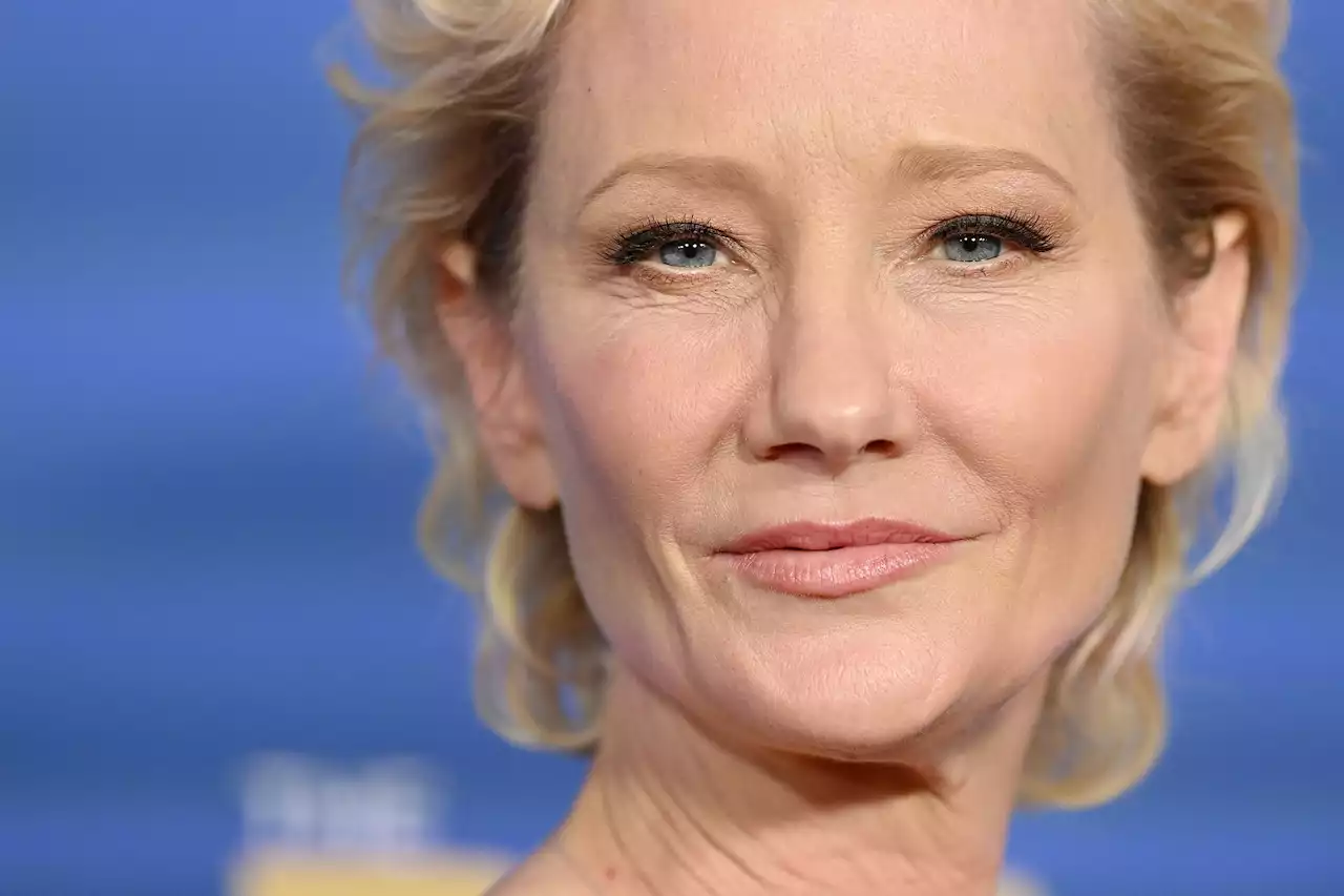 Actor Anne Heche Severely Burned After Fiery Car Crash Into Los Angeles House