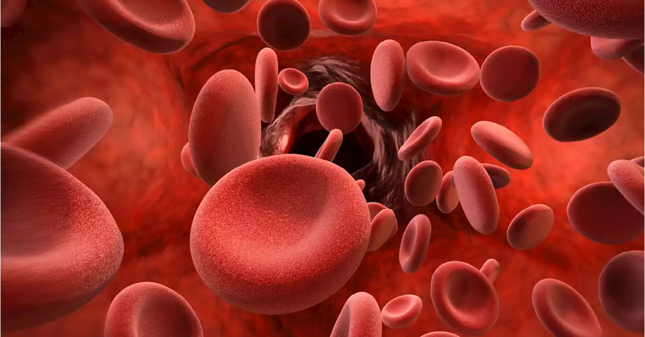 Blood Protein May Show Cancer Death and Diabetes Risks