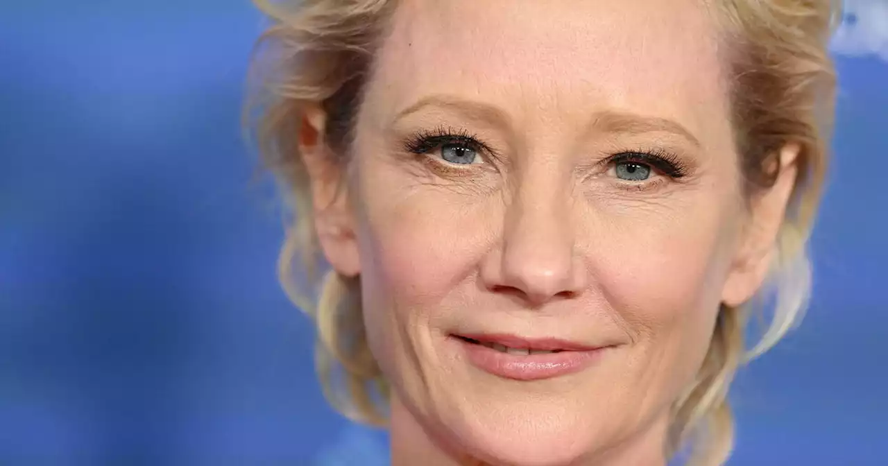 Actress Anne Heche hospitalized after car slams into L.A. home, sparks fire