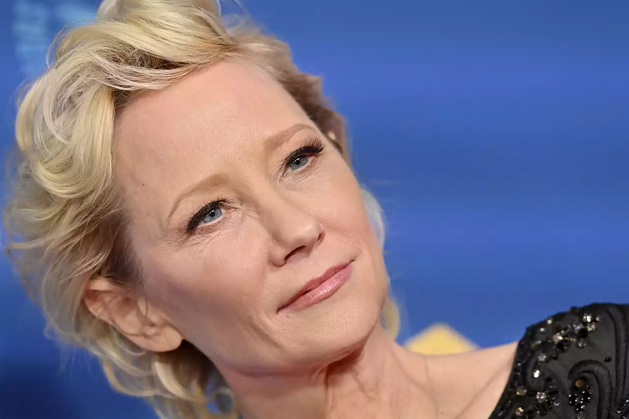 Actress Anne Heche in ‘Stable Condition' After Fiery Car Crash