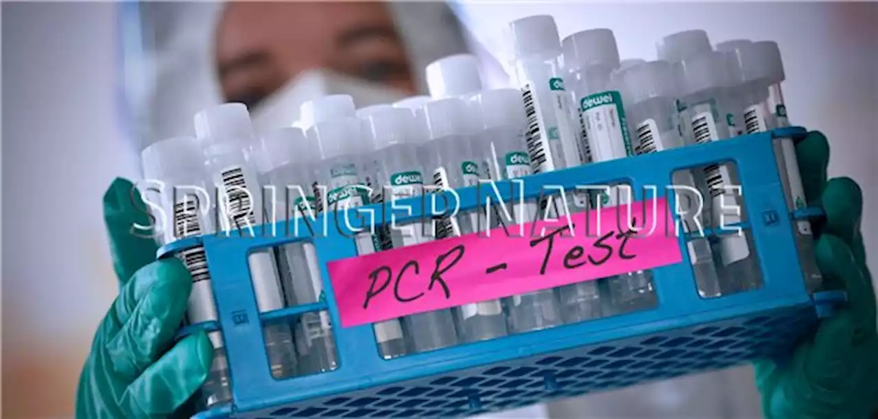 PCR-Tests weiter rückläufig bei hoher Positivrate