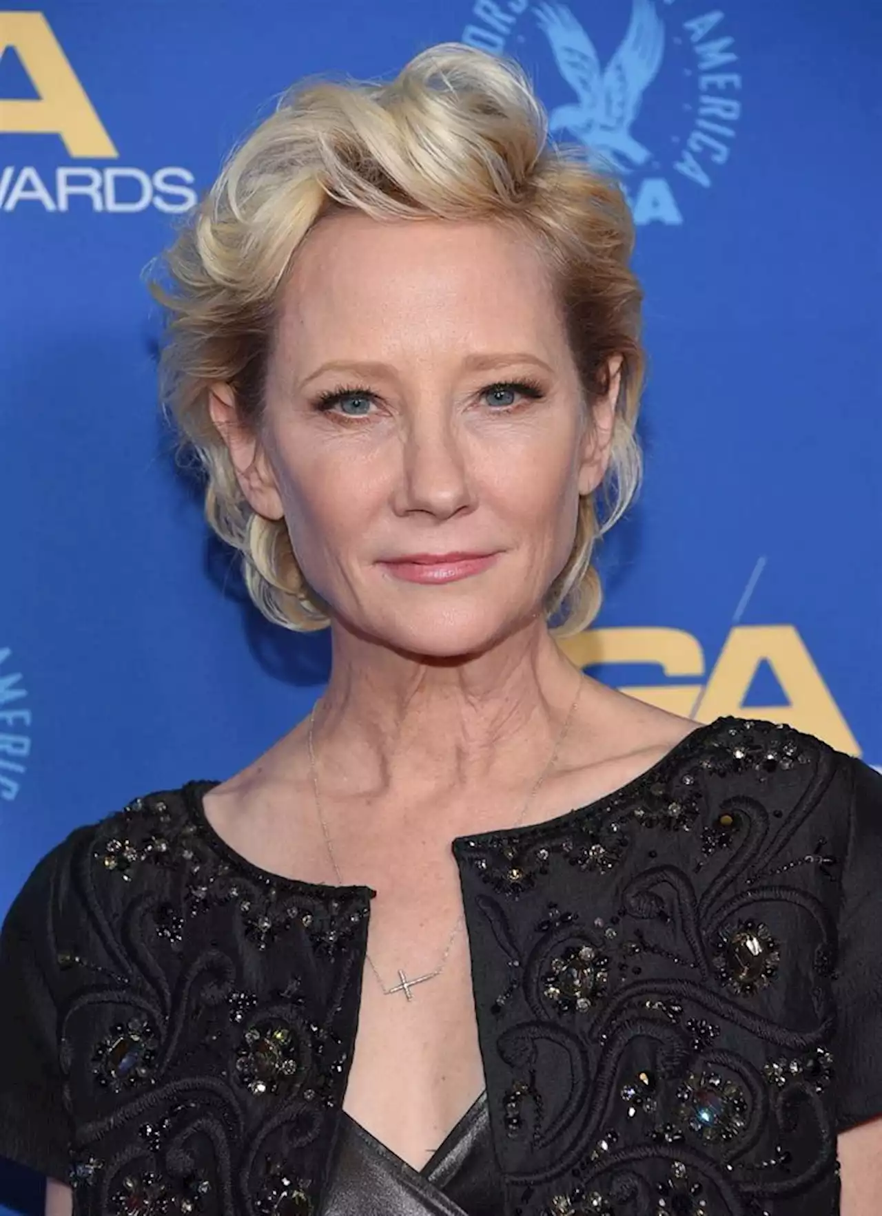 Anne Heche reportedly in coma following fiery car crash | Channel