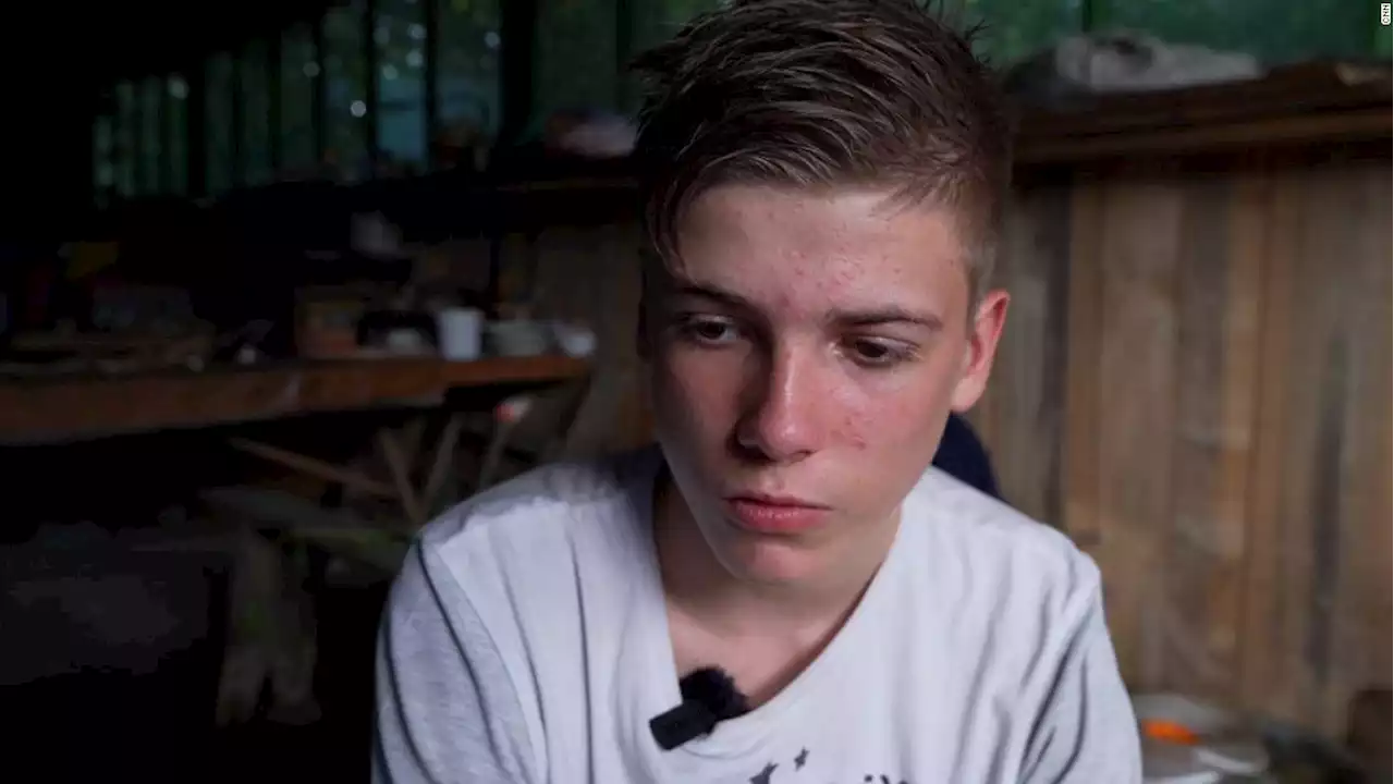 Injured by war, the scars on Ukraine's wounded children are more than skin deep