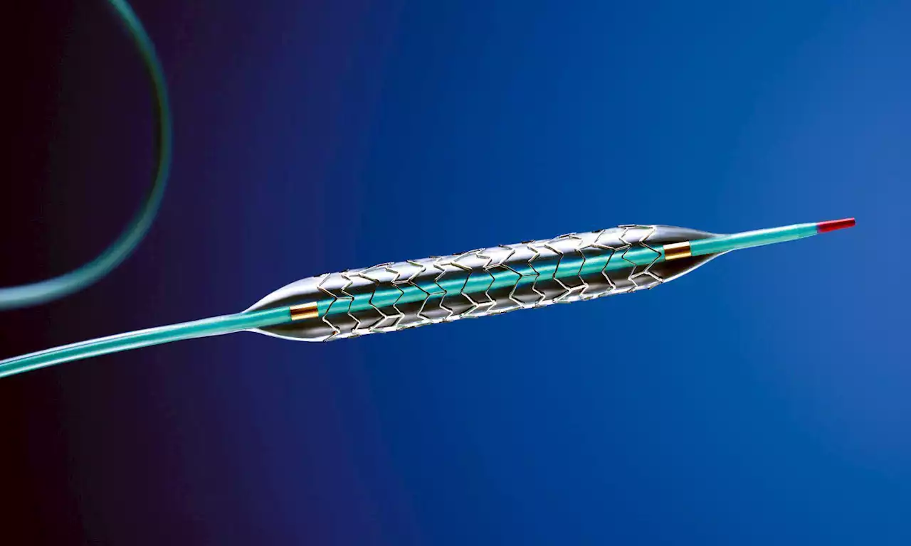 Weighing risks, rewards of stent surgery