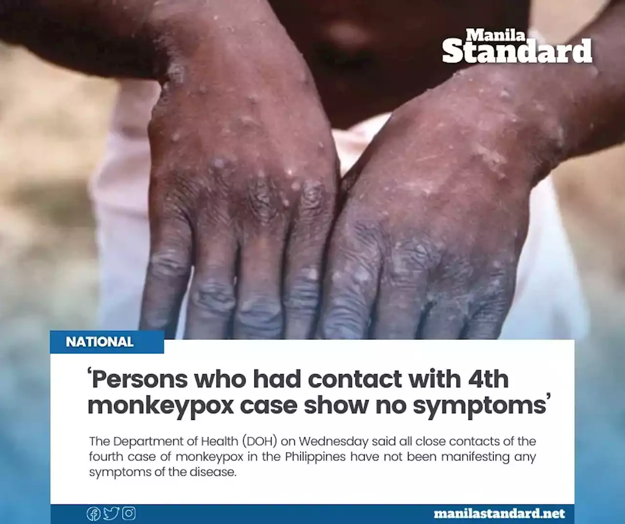 ‘Persons who had contact with 4th monkeypox case show no symptoms’