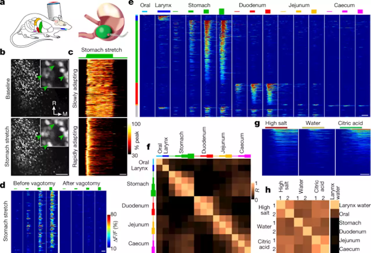 A brainstem map for visceral sensations - Nature