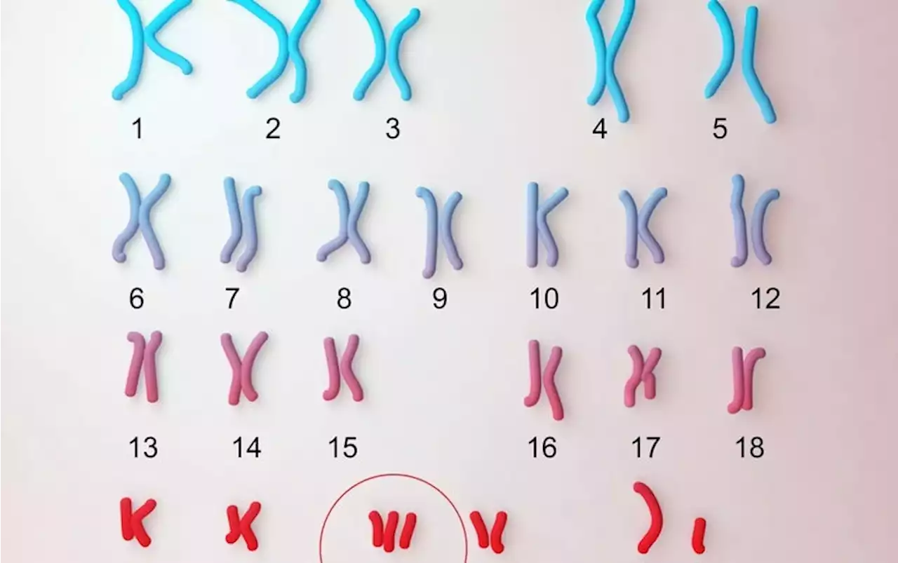 A Hormone May Boost Cognition in Down Syndrome