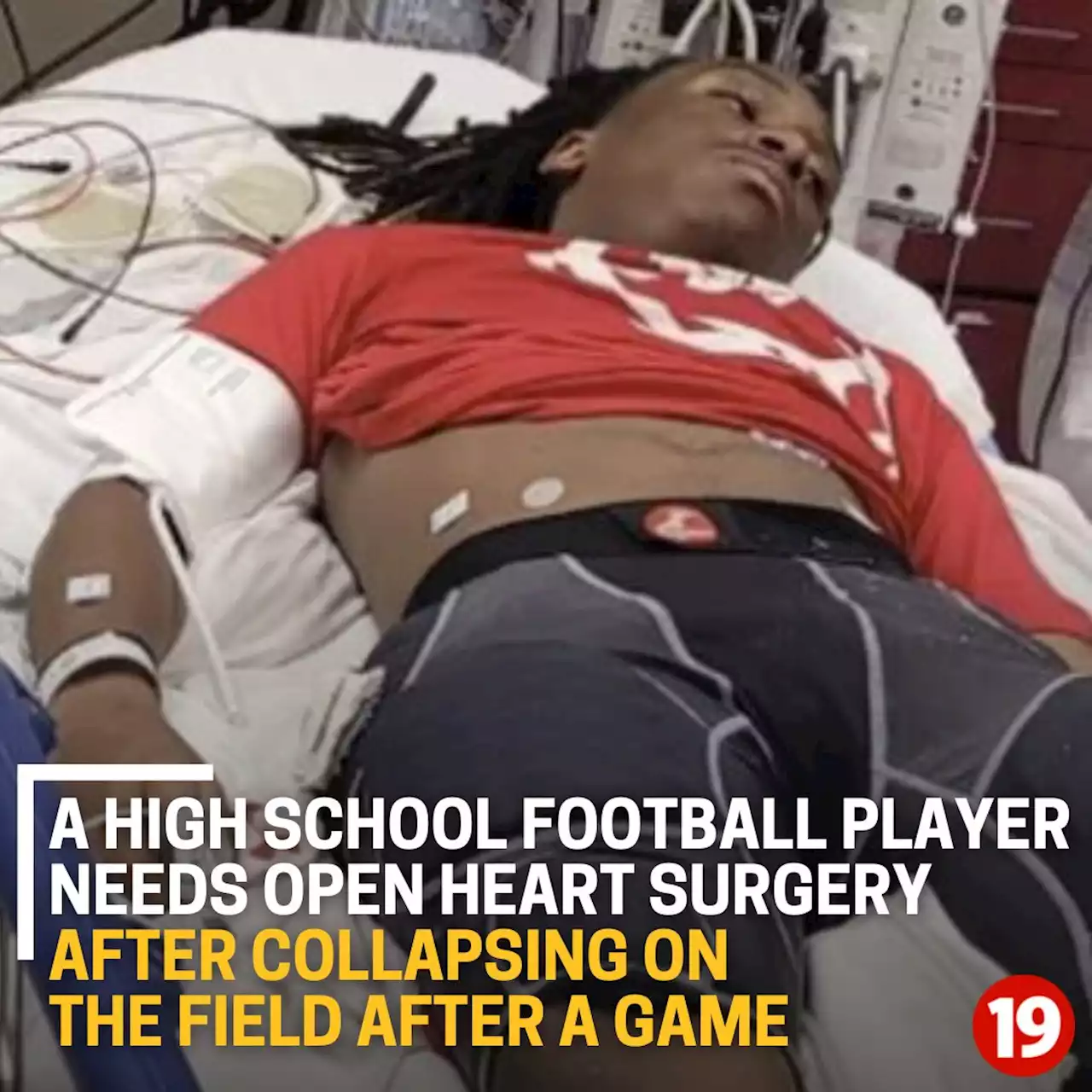 High school football player collapsed after game, needs open heart surgery