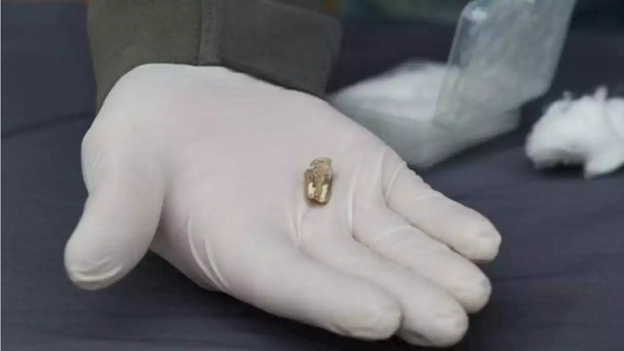 العثور على سن بشرية عمرها 1.8 مليون عام