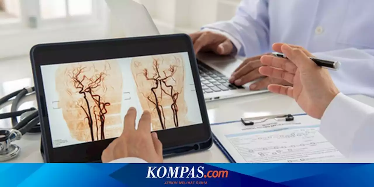 6 Gejala Stroke Penyumbatan Otak yang Perlu Diwaspadai