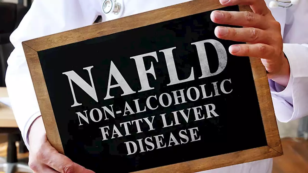 SGLT2 Inhibitors Lower NAFLD, HCC Risks Over DPP4i