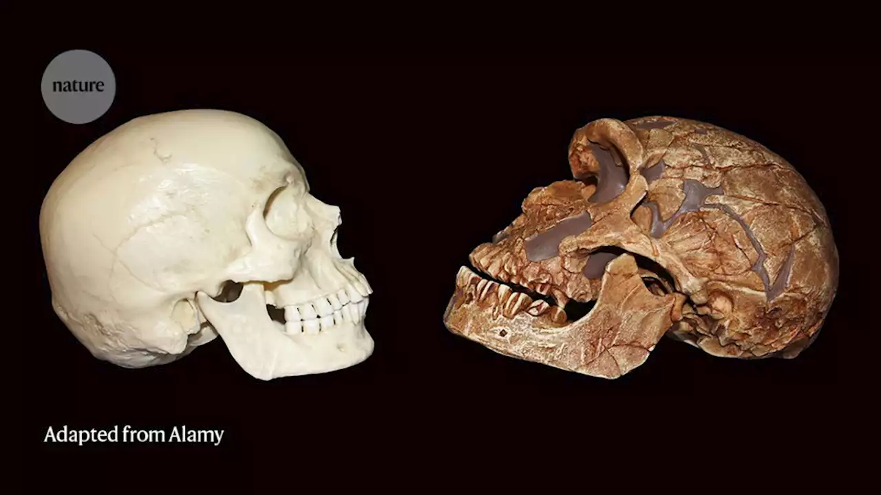 Did this gene give modern human brains their edge?