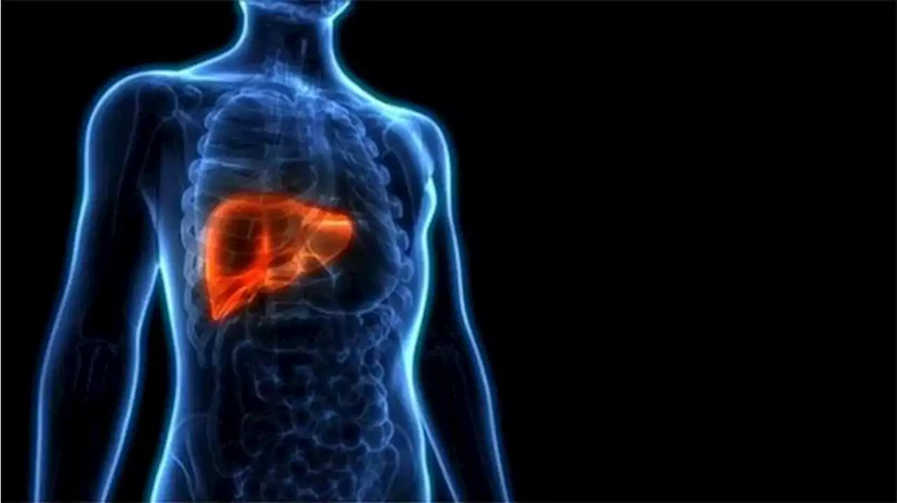 Cara Cegah Penyakit Hepatic Steatosis atau Lemak Hati: Gaya Hidup Sehat