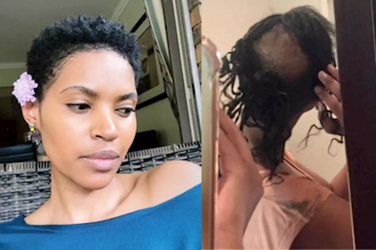 Gail Mabalane on alopecia: 'This is way more prevalent than we think'