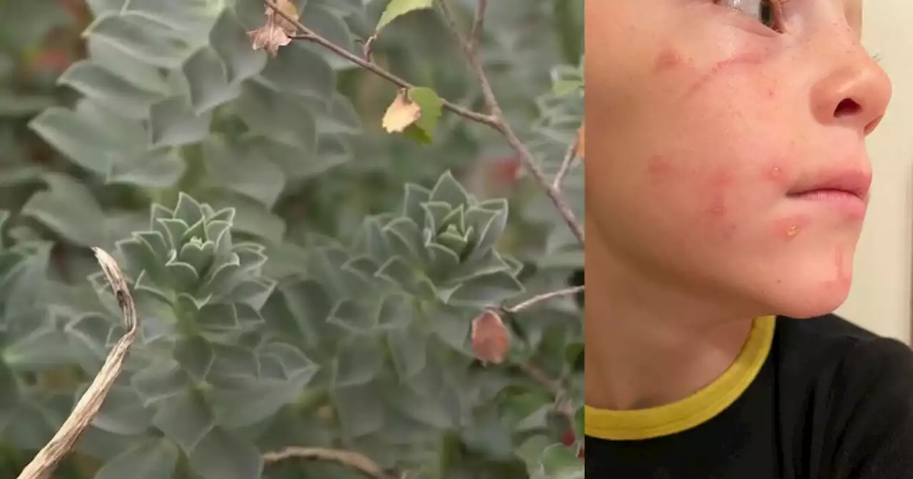 Utah County boy recovering from reaction to invasive plant