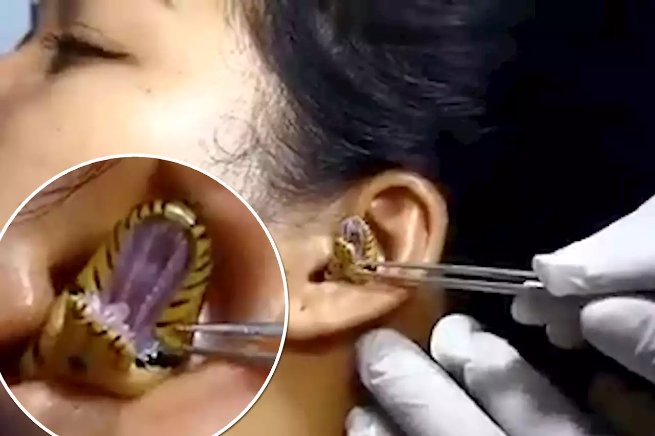 ‘Surgeon’ struggles to remove live snake from woman’s ear in viral video