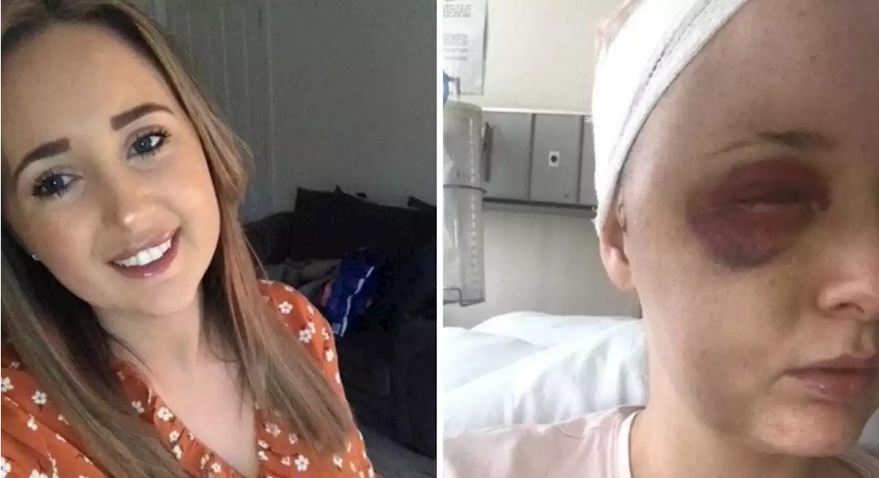 Woman’s ‘toothache’ turned out to be a symptom of a brain tumour