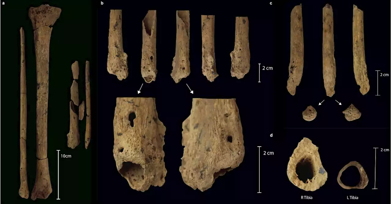 The Earliest Evidence of An Amputation is 31,000 Years Old