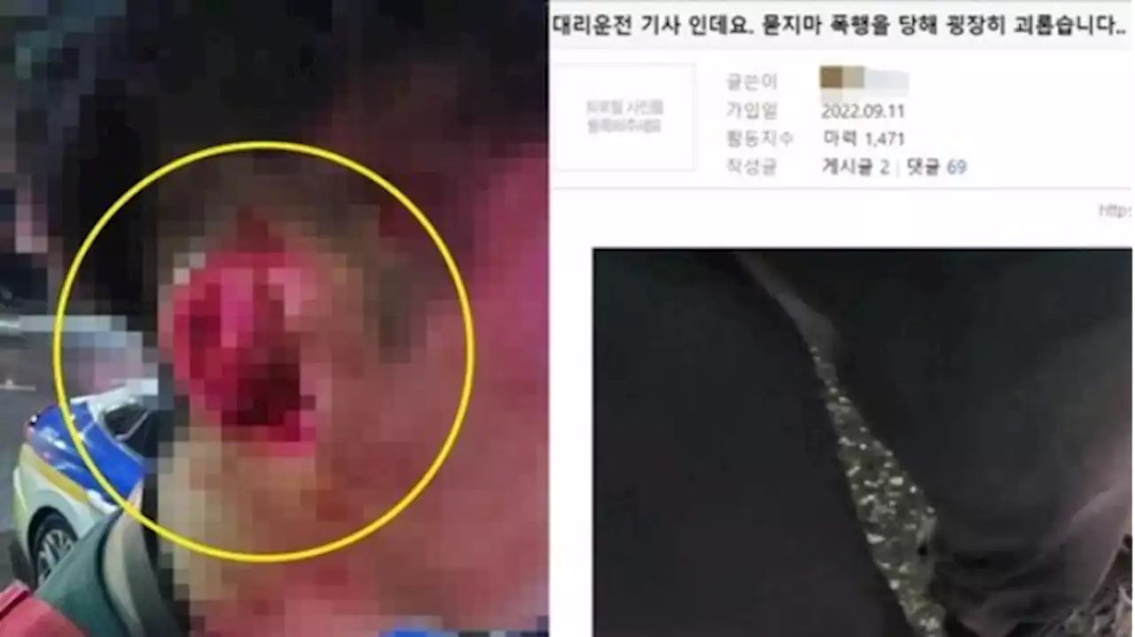 '예?' 되묻자 주먹 날아왔다...고객 무차별 폭행에 피범벅된 대리기사