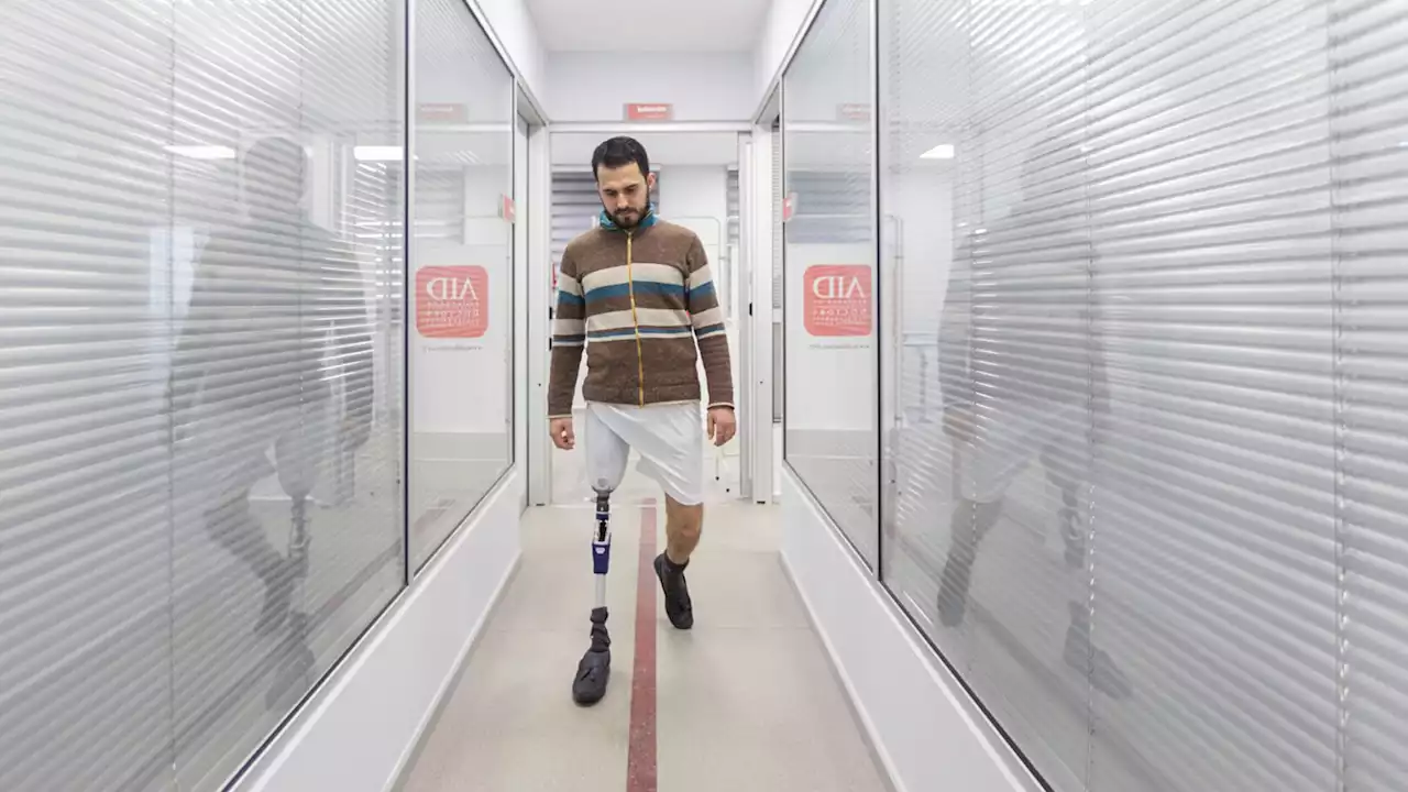 A Turkish clinic swaps refugees' warzone-welded prosthetics for free 3D-printed ones