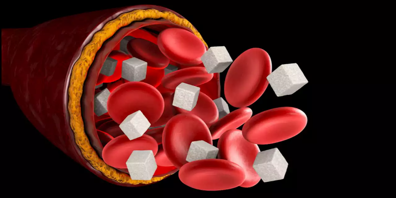 Hyperglycemia Clinical Practice Guidelines (ES, 2022)