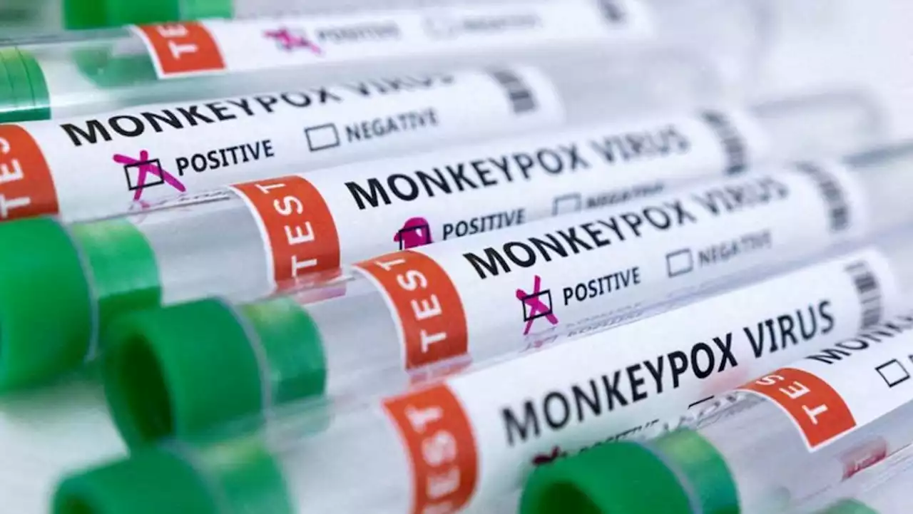 Don't touch foreigners to reduce monkeypox risk, says senior Chinese health official