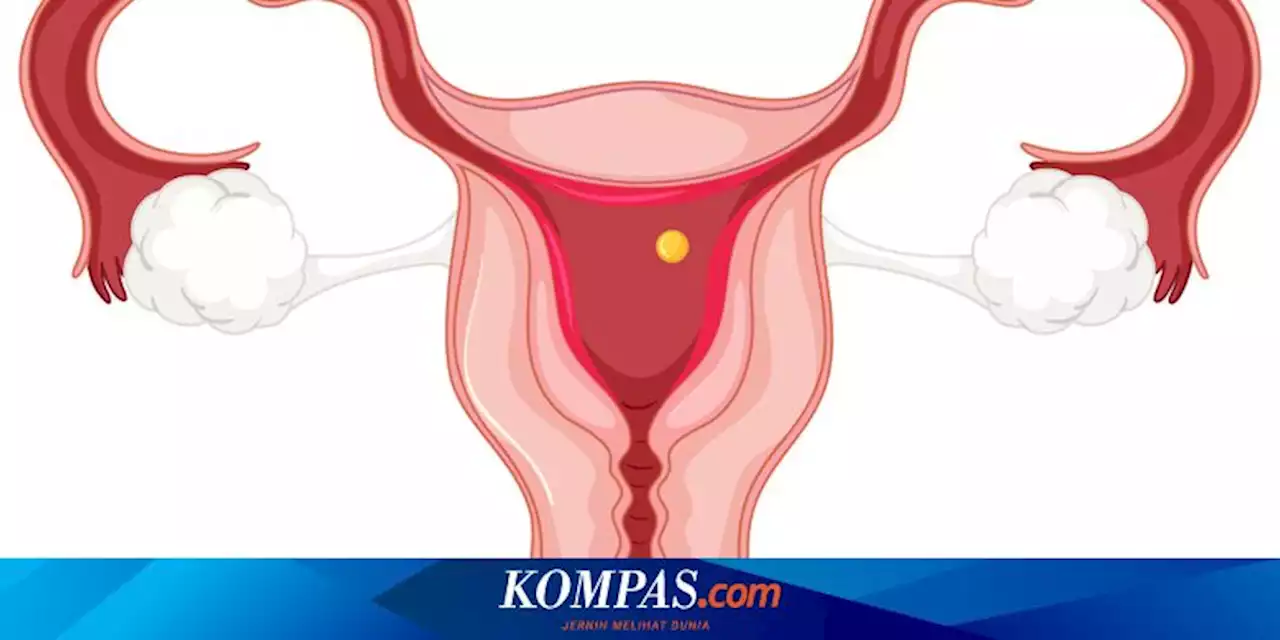 Apa Itu Ovarium Bengkok? Begini Penjelasan Dokter Kandungan