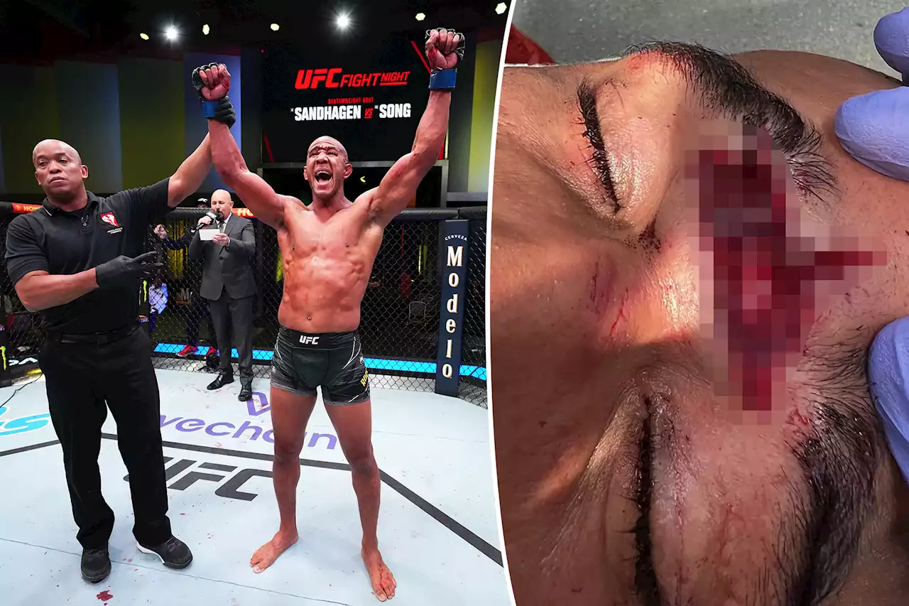 Dana White shares unsettling photo of Greg Rodrigues cut after UFC Fight Night