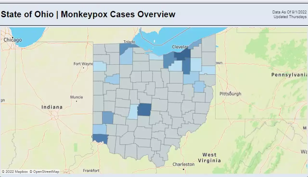 Cuyahoga County has 90 of 184 monkeypox cases in Ohio: Weekly update