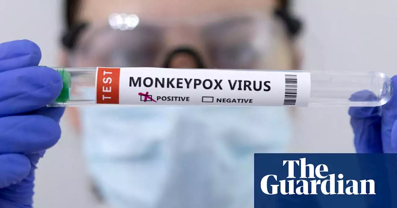 Second monkeypox strain found in the UK