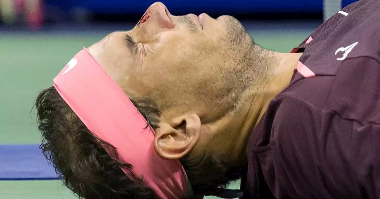 Rafael Nadal bloodied but unbowed after US Open fightback against Fognini