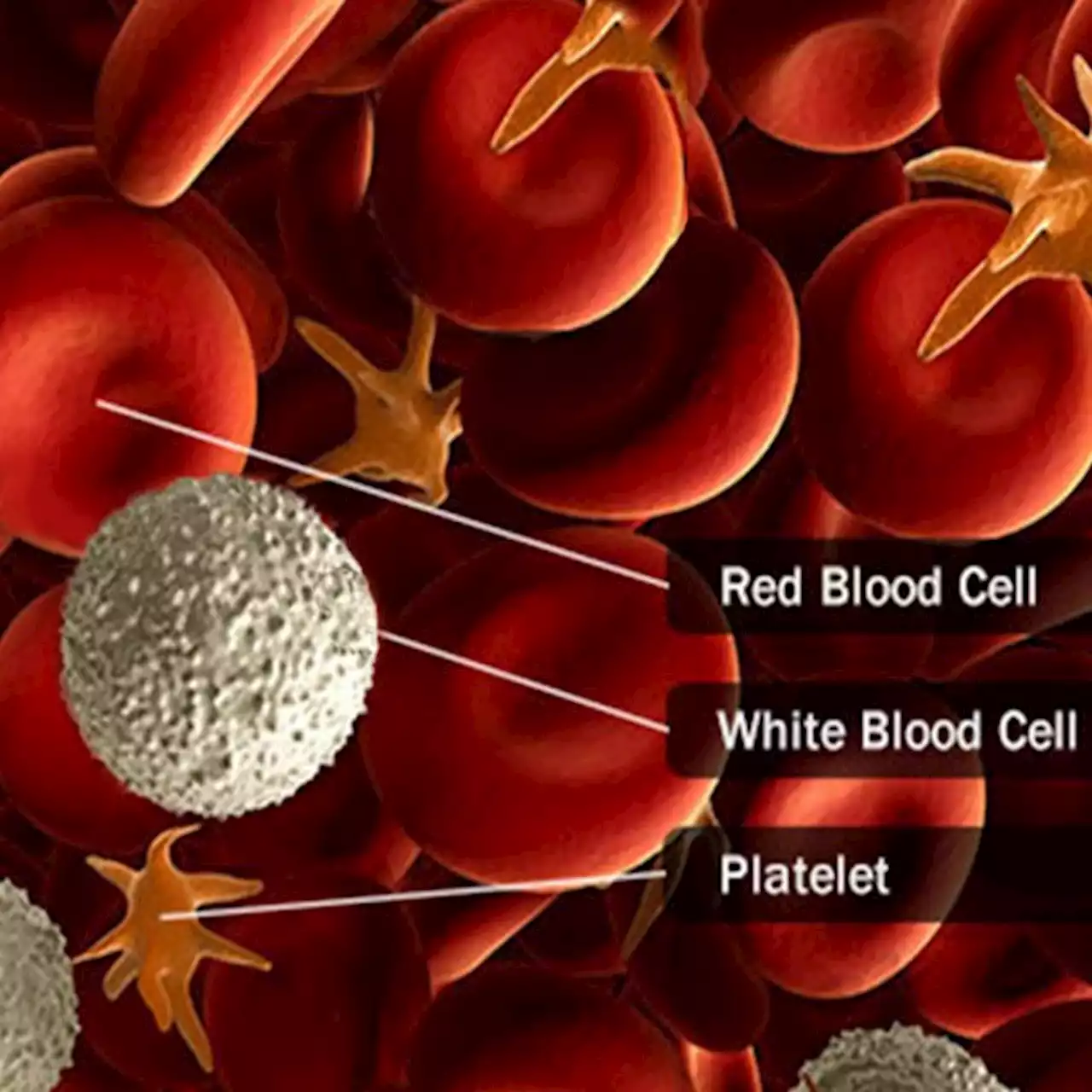 Blood Cancer Types: Leukemia, Lymphomas, Myelomas, and More