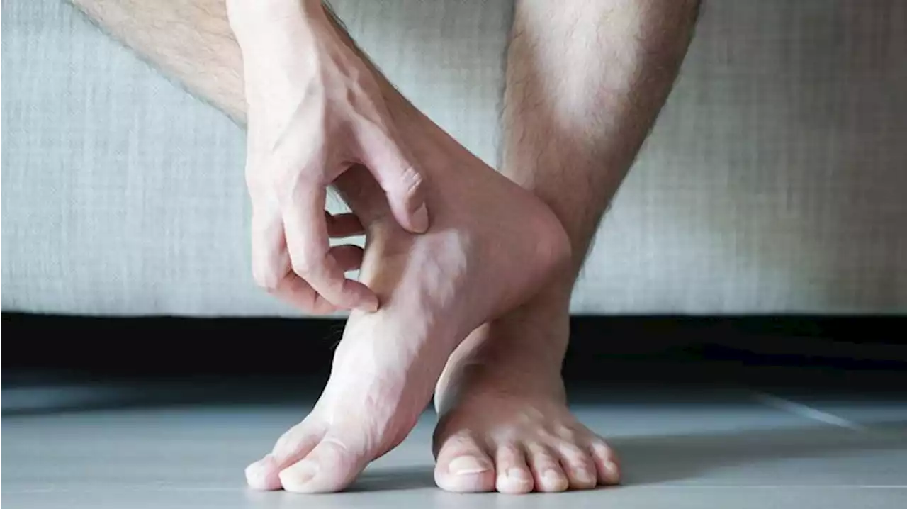 Itchy feet? Here's how to tell if you have athlete's foot