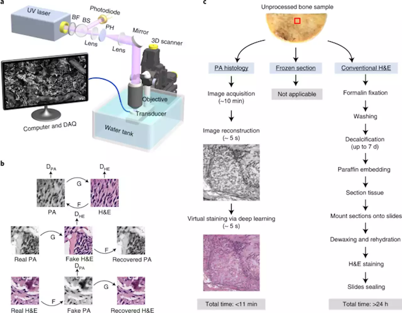 Label-free intraoperative histology of bone tissue via deep-learning-assisted ultraviolet photoacoustic microscopy - Nature Biomedical Engineering