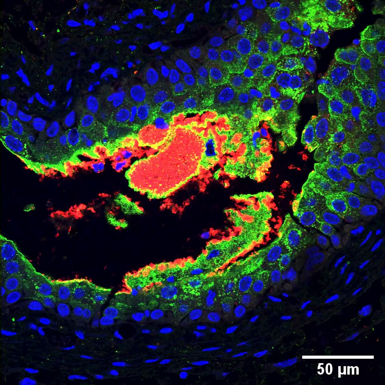 Link Between Diabetes and UTIs Uncovered by New Research