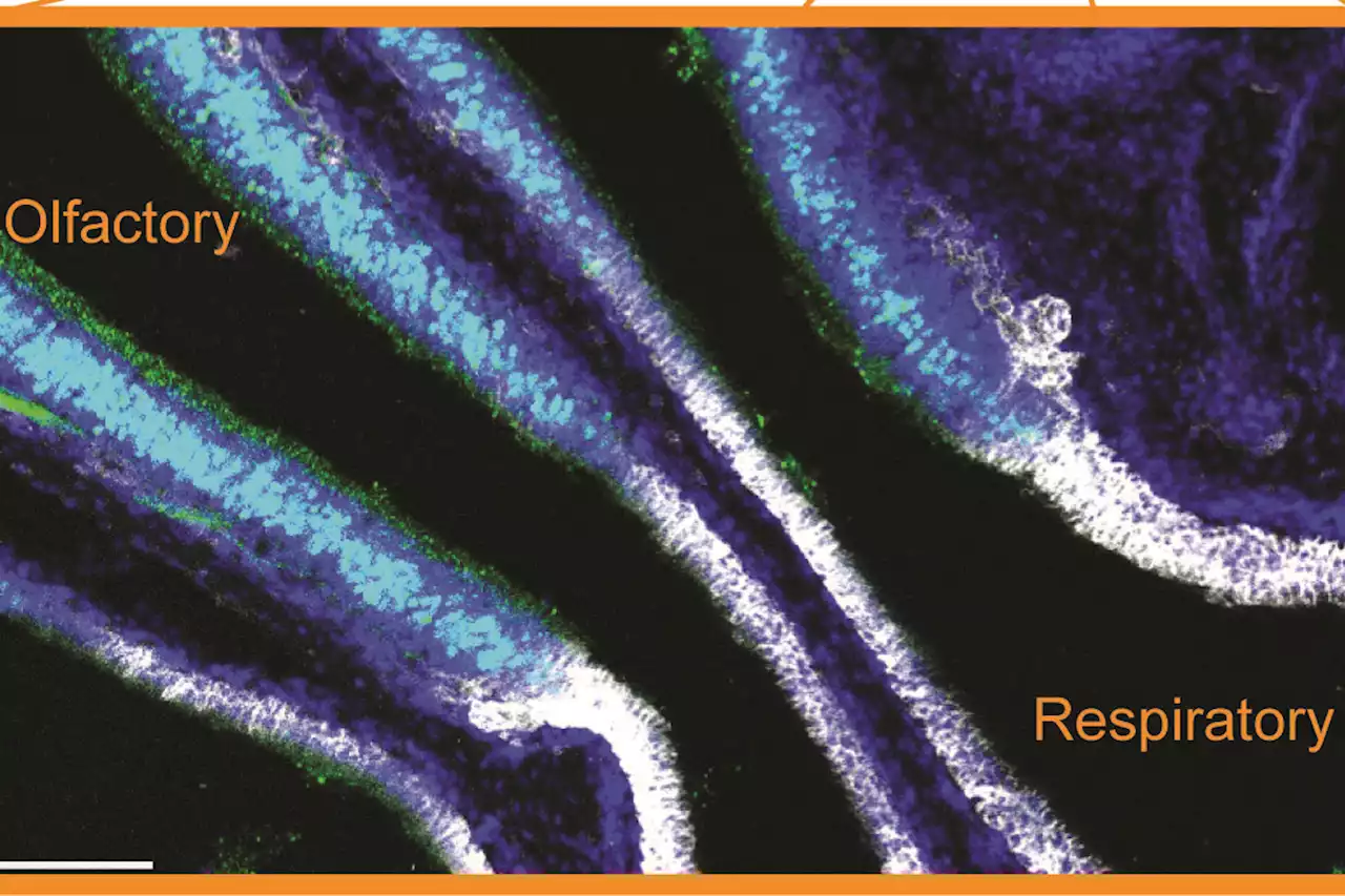 Newly discovered barrier prevents immunity from reaching smell-sensing cells