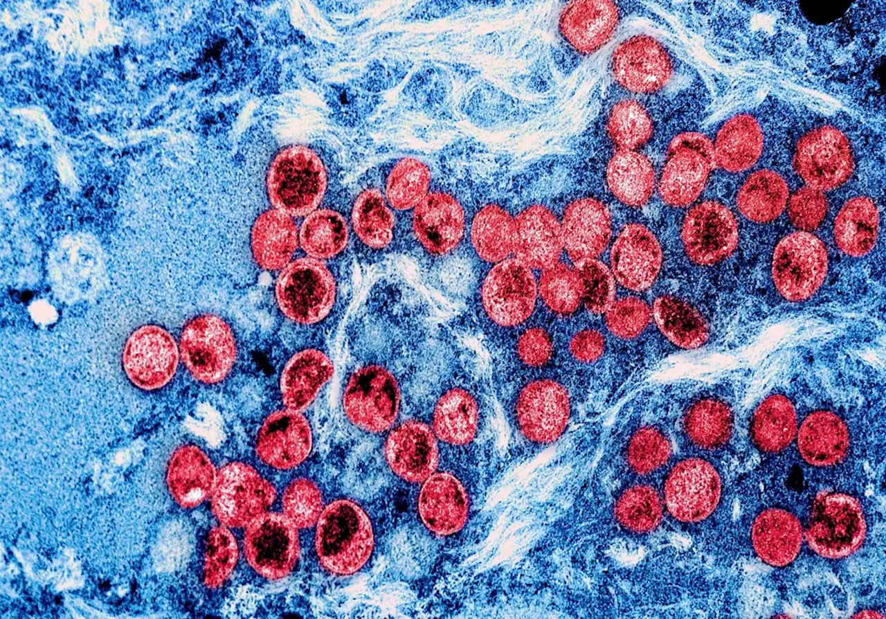 Evidence A.2 lineage of monkeypox is mutating