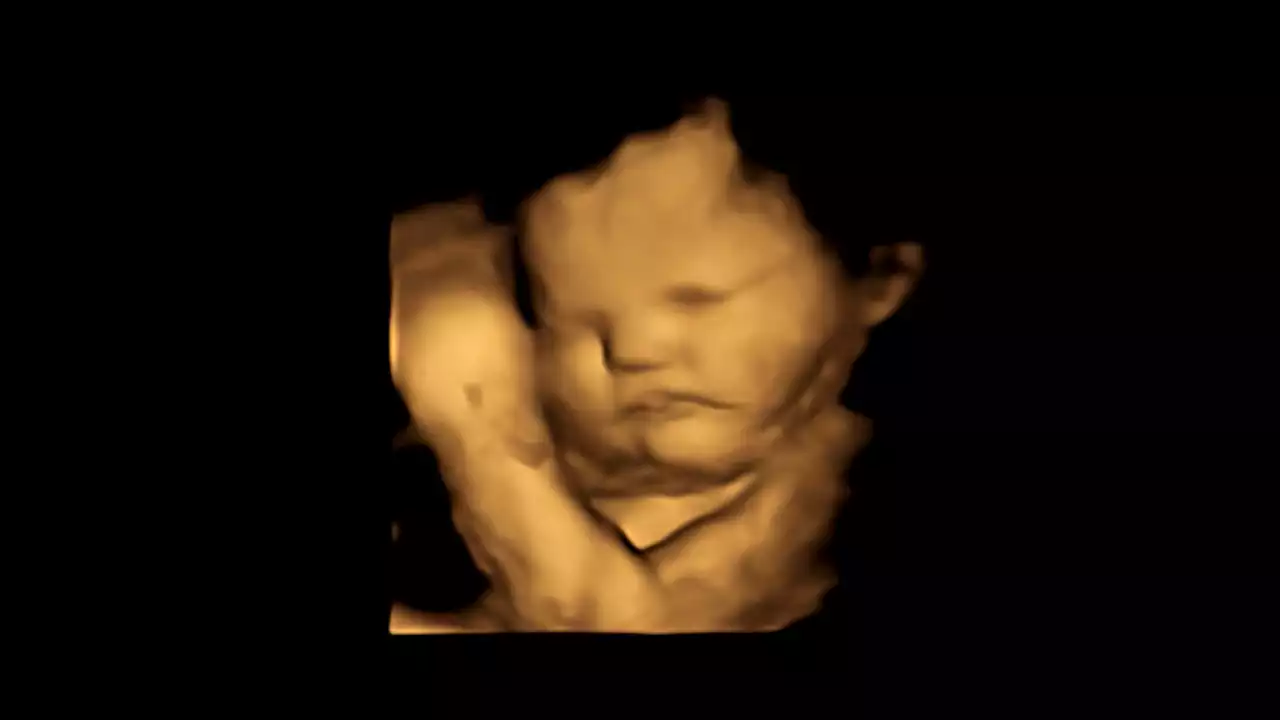 First direct evidence that babies react to taste and smell in the womb