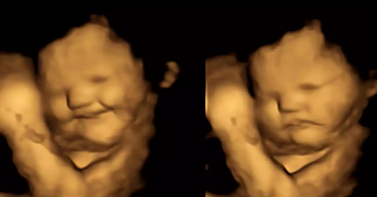 Babies smile over carrots and scowl over kale inside the womb